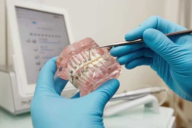 Выбор материала и техники для эффективного лечения зубного протезирования - секреты успешного результата