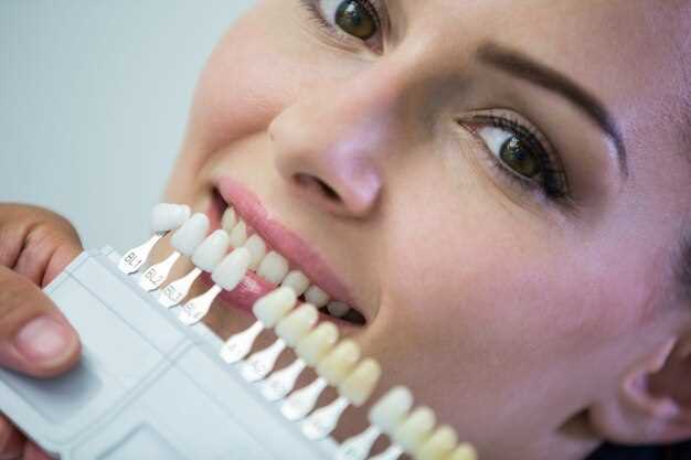 Эстетическая стоматология: преображение улыбки без боли и долгого лечения