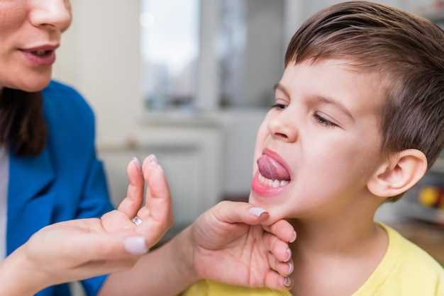 Симптомы гингивита у детей