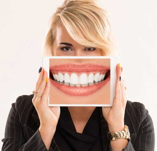 Имплантация зубов - идеальное решение для восстановления утраченной улыбки
