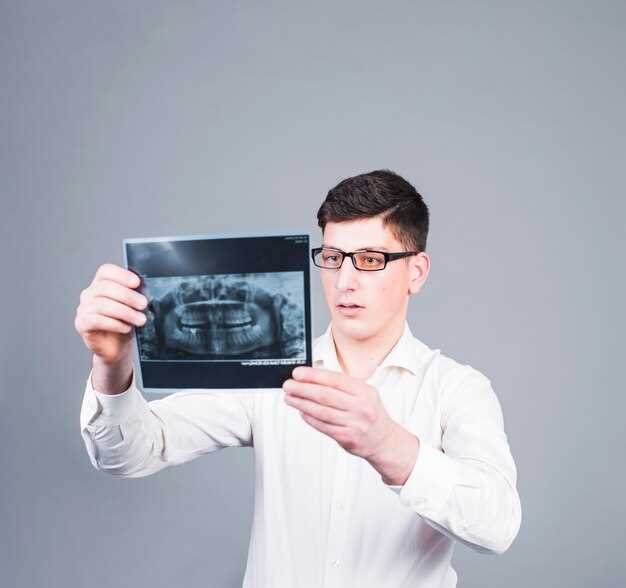 3D-печать в ортодонтии: создание персонализированных аппаратов