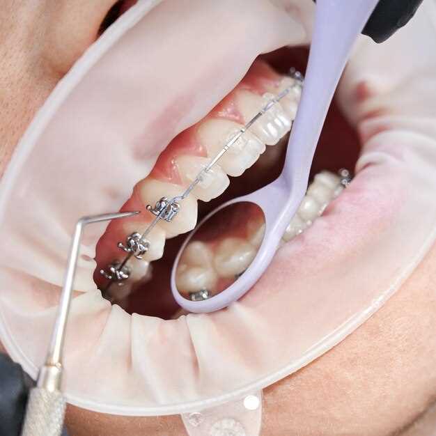 Ортодонтия: преимущества и особенности лечения зубных аномалий
