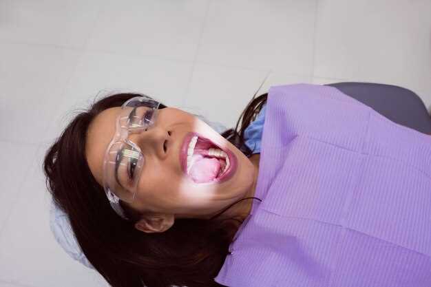 Отбеливание зубов - секреты успешной процедуры и долговременного эффекта