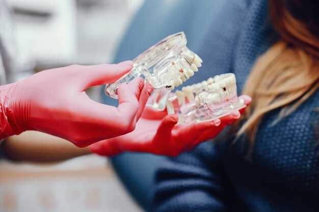 Протезирование зубов за рубежом: выгодно ли?