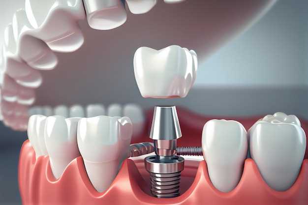 Этапы подготовки к стоматологической имплантации: